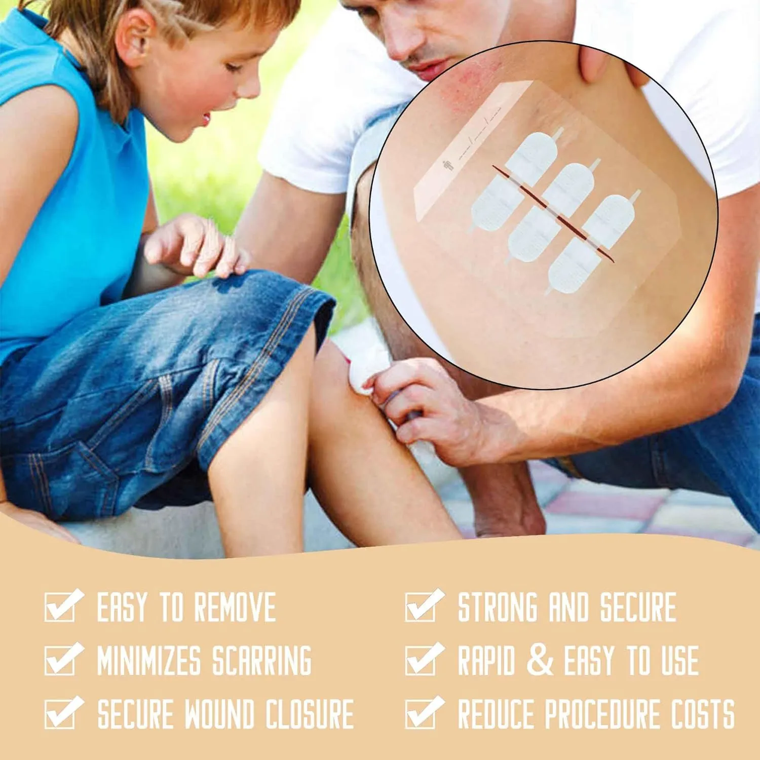 Emergency Wound Closure Strips Kit Set,Sutures Butterfly Bandaids, Ifak Trauma Kit Refill First Aid Supplies for Hiking Camping Backpacks, Zip Stitch Wound Closure Strips (White, Small)