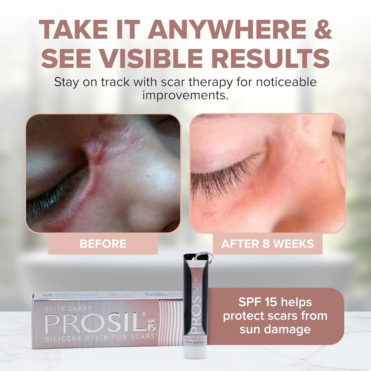ProSil Elite Carry with SPF 15 – Patented Scar Treatment in a Portable Keychain – Smooth Glide-On, Professional-Grade Silicone Scar Stick - Mess-Free, Travel-Friendly & Lightweight – Rose Gold Sleeve