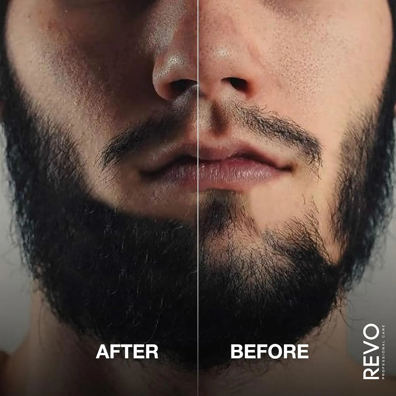 REVO Hair Building Fibers - 25g Hair Fibers for Thinning Hair, 100ml Fiberhold Spray & Hairline Optimizer - Hair Fibers for Bald Spot Cover Up, Scalp Concealer & Volume for Men & Women - Black