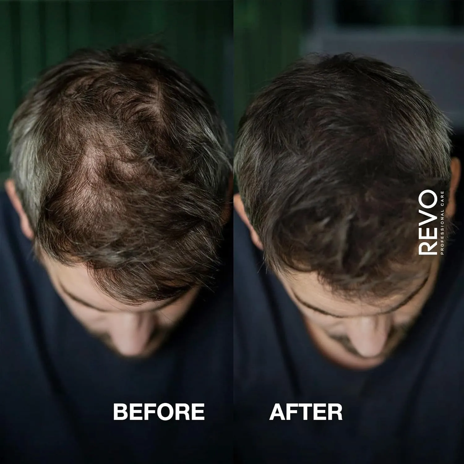 REVO Hair Building Fibers - 25g Hair Fibers for Thinning Hair, 100ml Fiberhold Spray & Hairline Optimizer - Hair Fibers for Bald Spot Cover Up, Scalp Concealer & Volume for Men & Women - Black