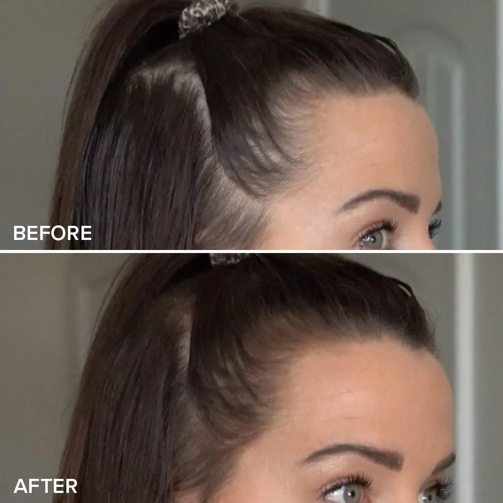 TRUHAIR Color & Conceal Waterproof Root Touch Up Hair Color Concealer - Hair Cover up for Gray Coverage and Hairline Filling - 11 Hair Colors Available (Darkest Brown)